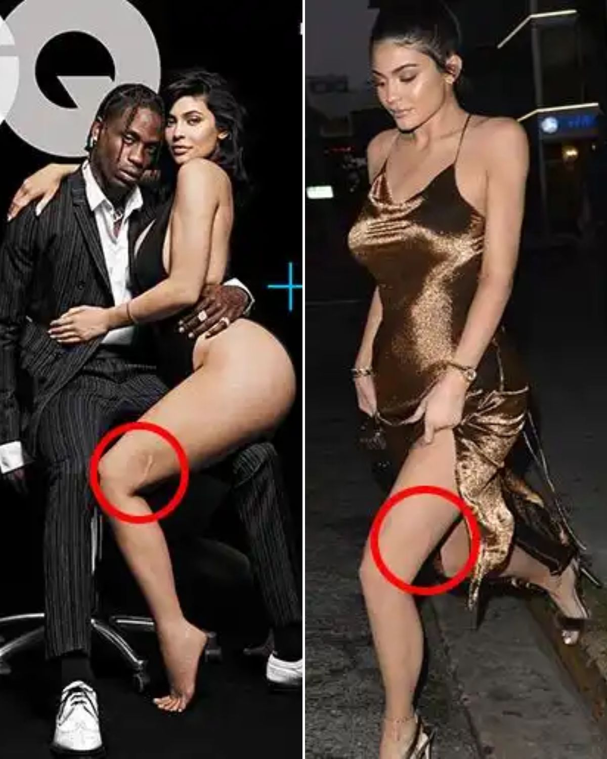 Cover Image for Kylie Jenner reveals the gory story behind the huge scar on her leg – and it’s partly Kendall’s fault